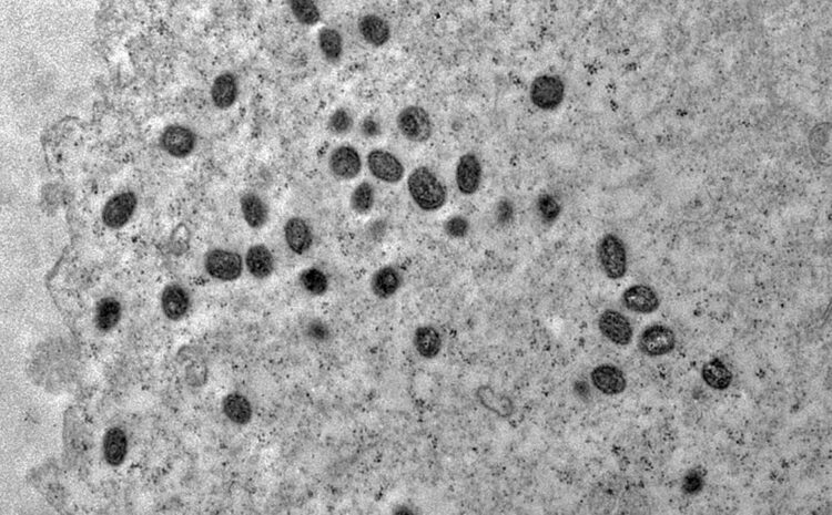  Teste para detectar varíola dos macacos é incorporado ao rol